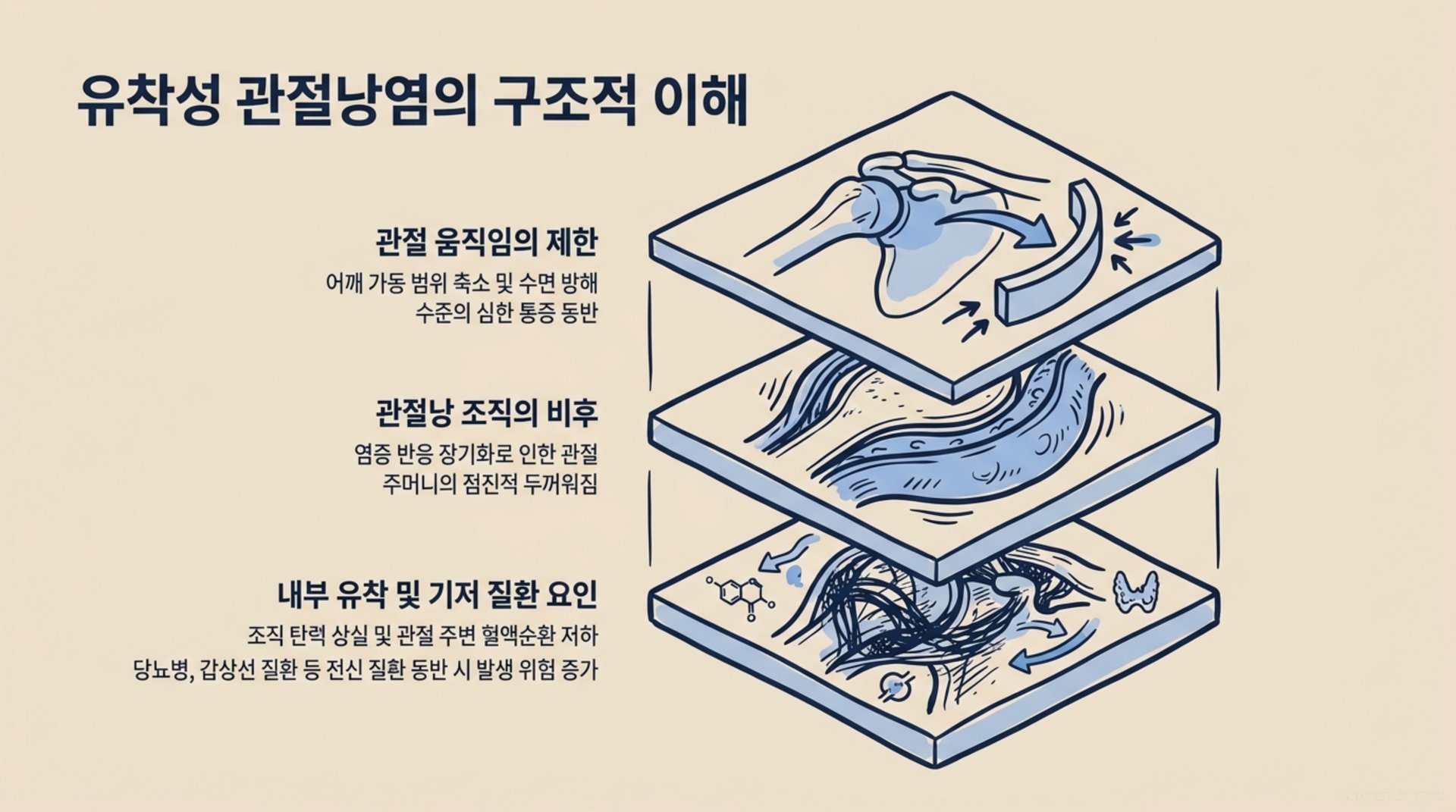 북가좌동 한의원 유착성 관절낭염의 구조적 이해 안내 이미지