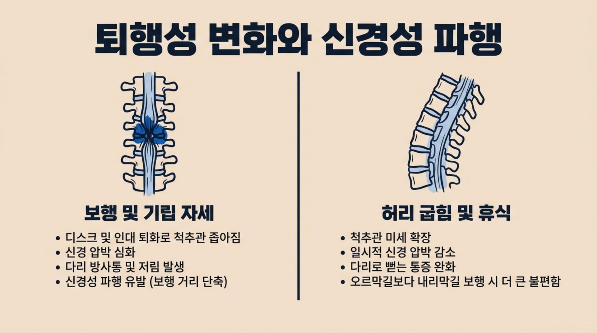 북가좌동 한의원 퇴행성 변화와 신경성 파행 안내 이미지