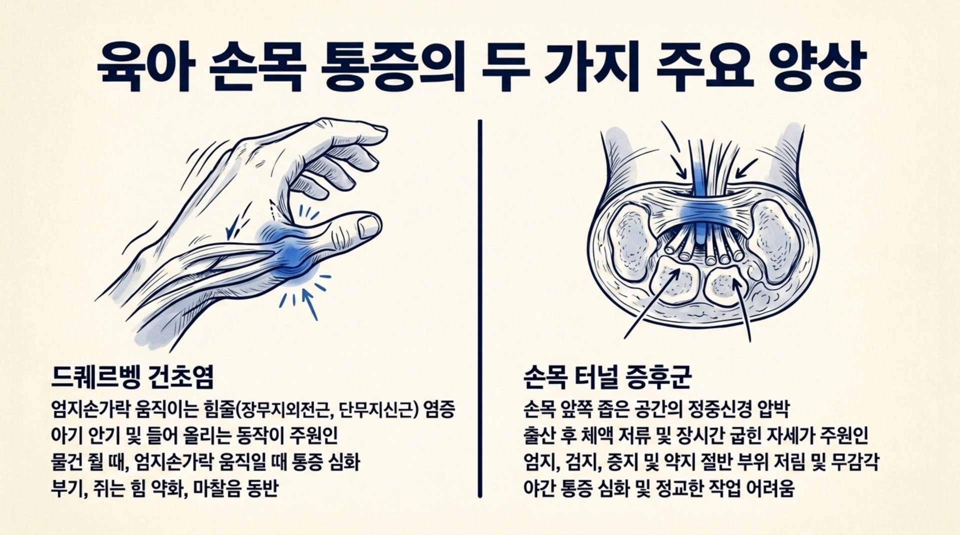 북가좌동 한의원 육아 손목 통증의 두 가지 주요 양상 안내 이미지