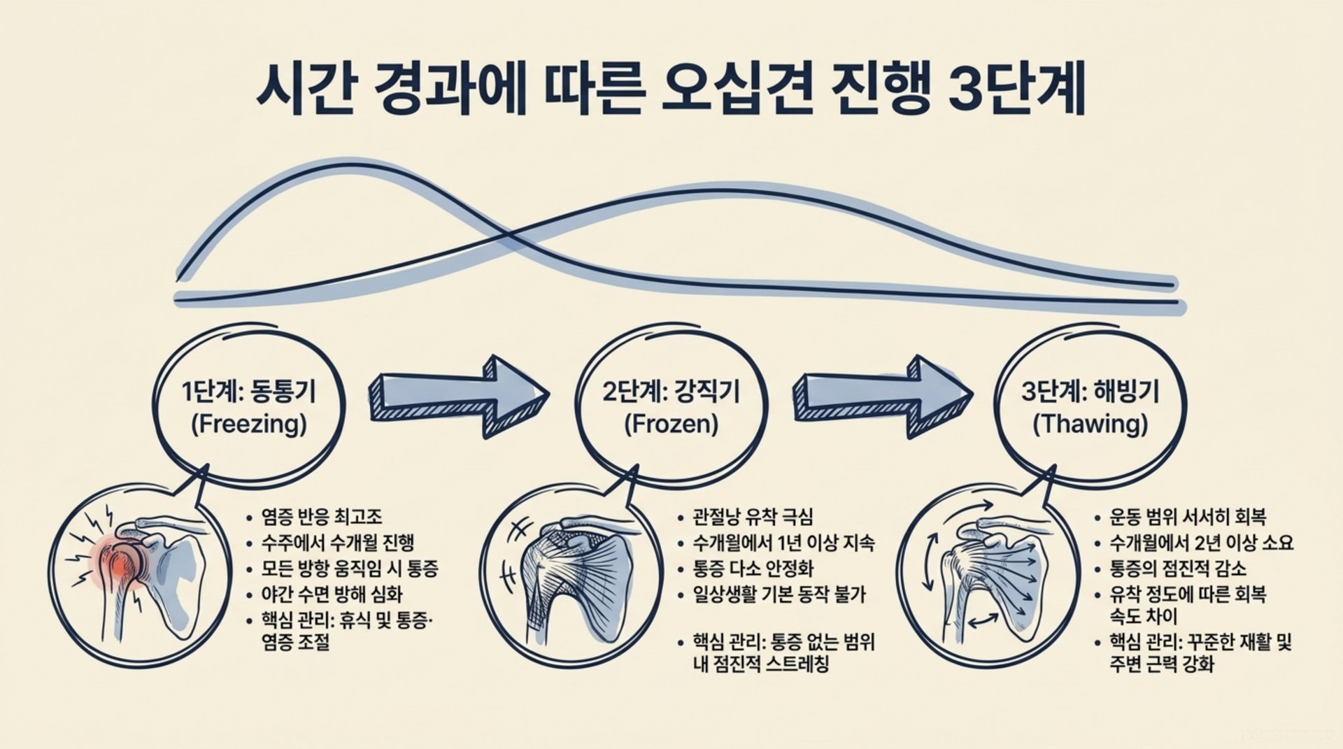 서대문구 한의원 시간 경과에 따른 오십견 진행 3단계 안내 이미지