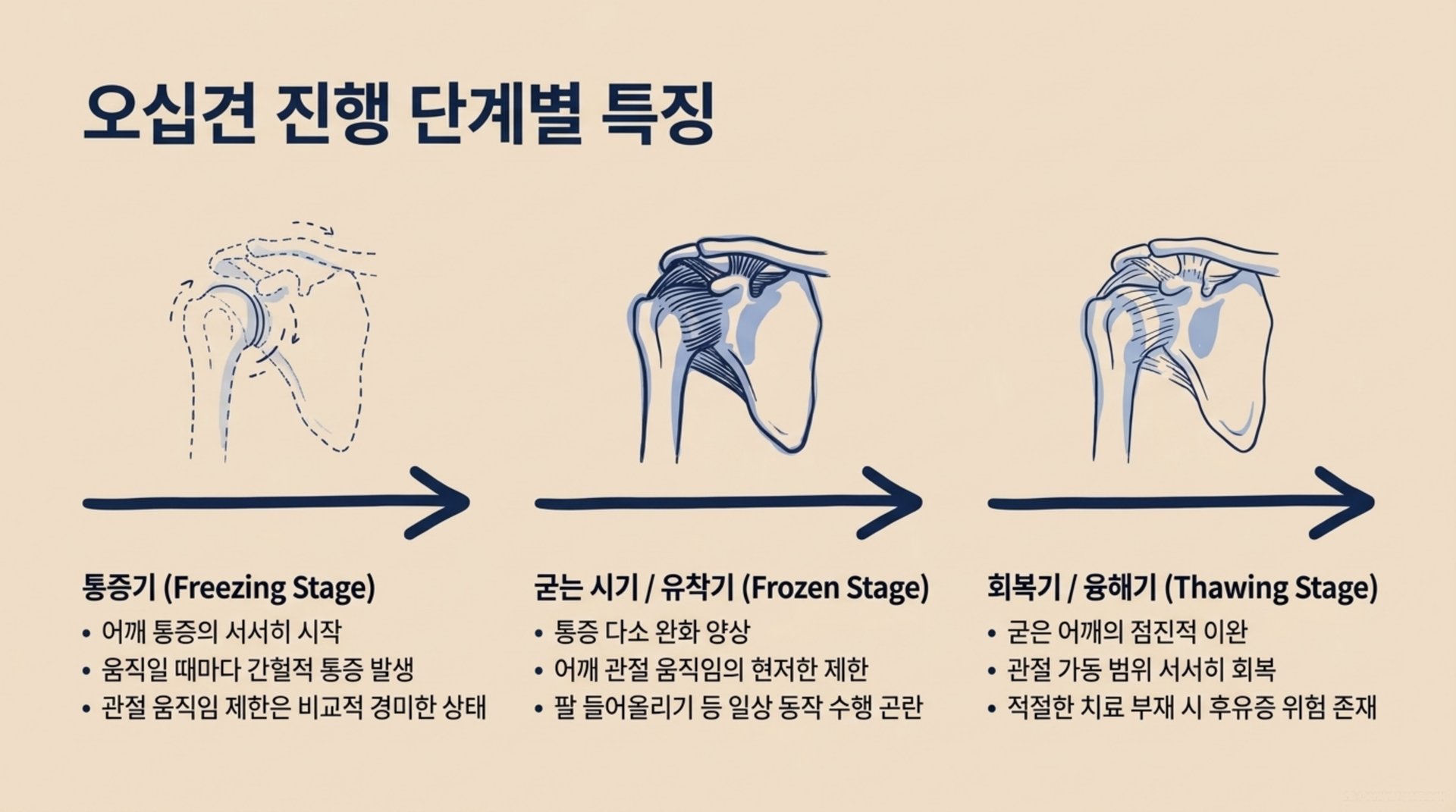 서대문구 한의원 오십견 진행 단계별 특징 안내 이미지