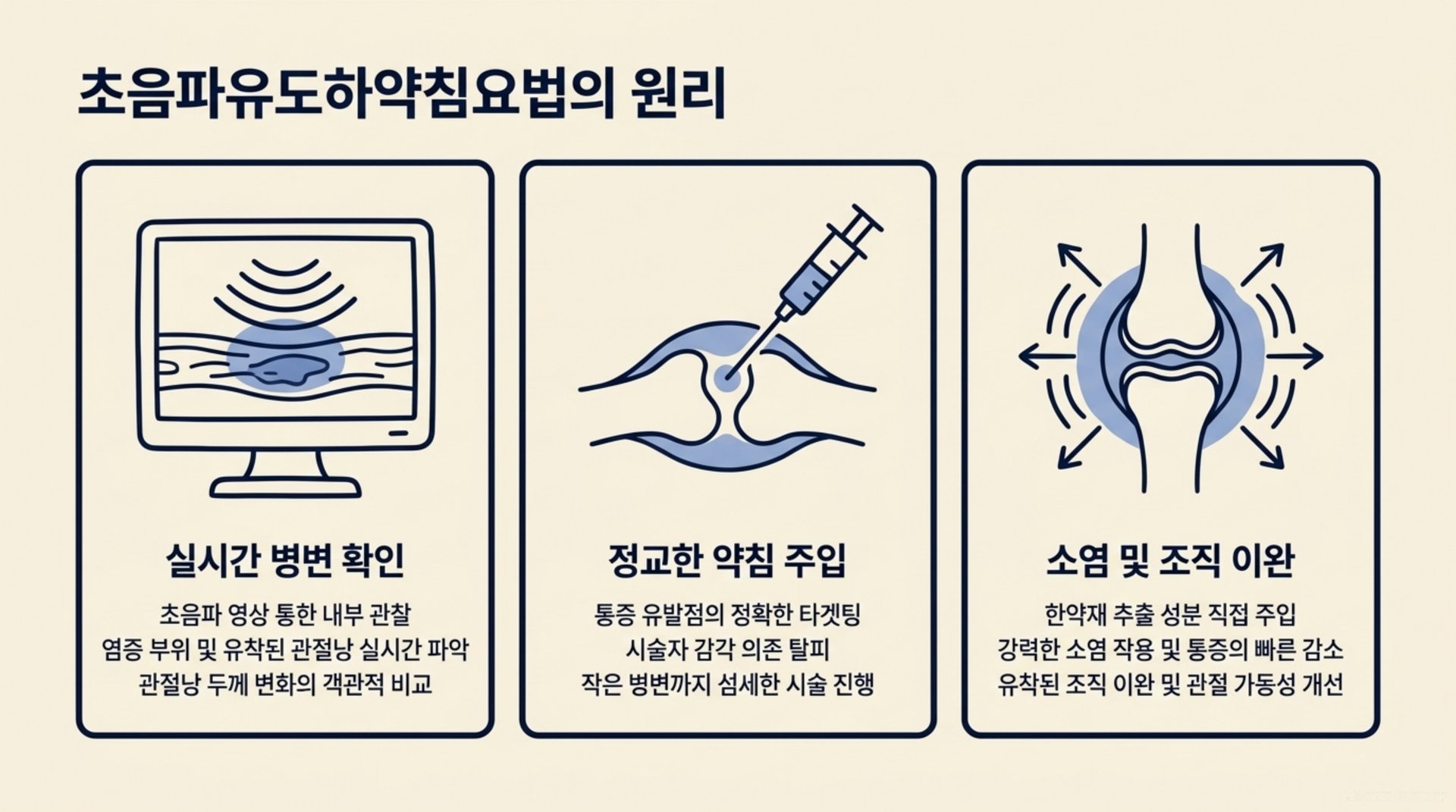 북가좌동 한의원 초음파유도하약침요법의 원리 안내 이미지