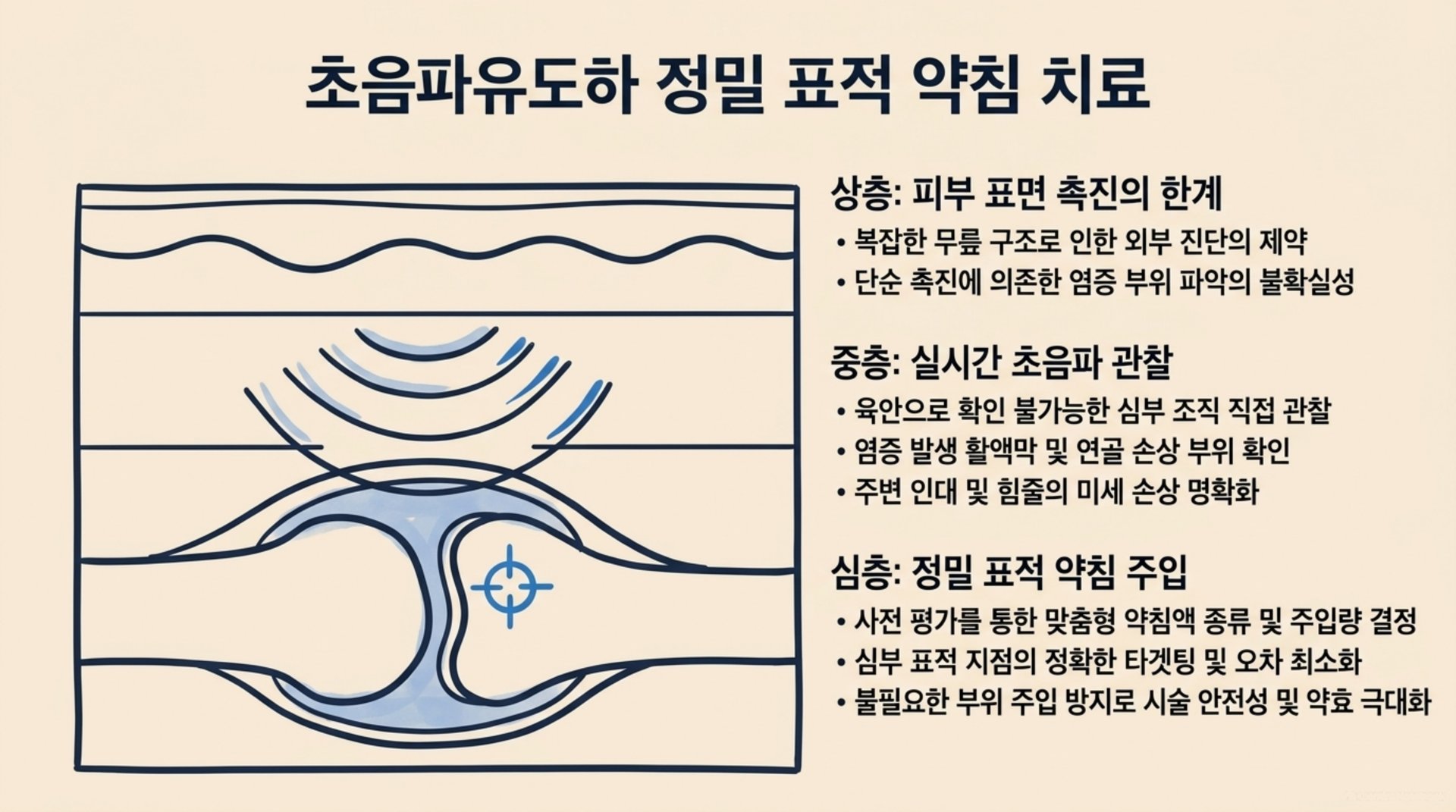 북가좌동 한의원 초음파유도하 정밀 표적 약침 치료 안내 이미지