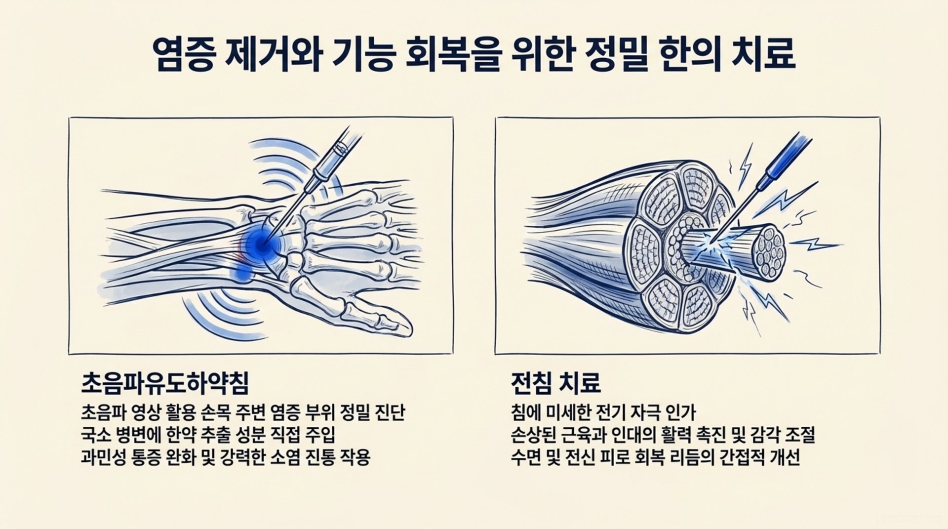 북가좌동 한의원 염증 제거와 기능 회복을 위한 정밀 한의 치료 안내 이미지