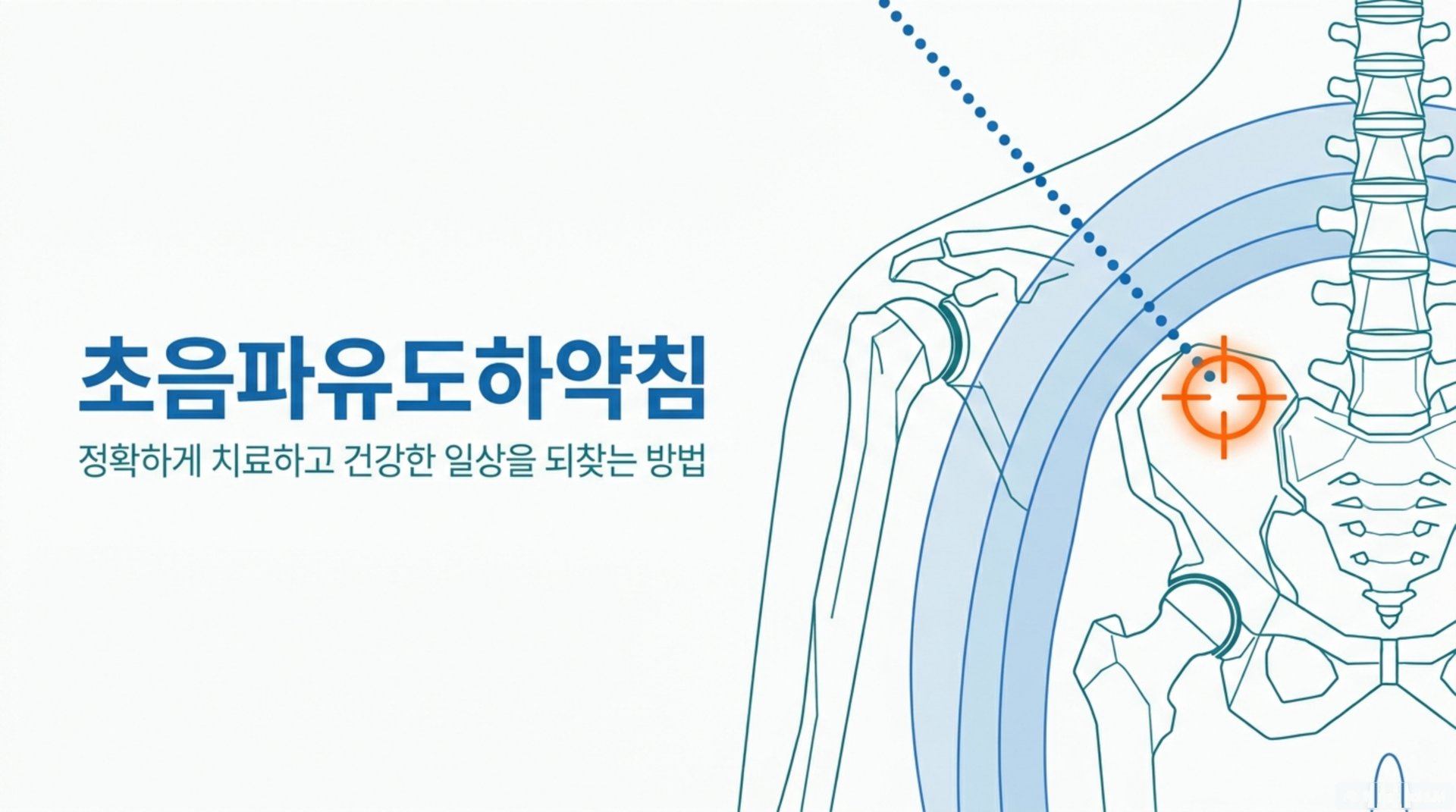 임상적 소견: 초음파유도하약침