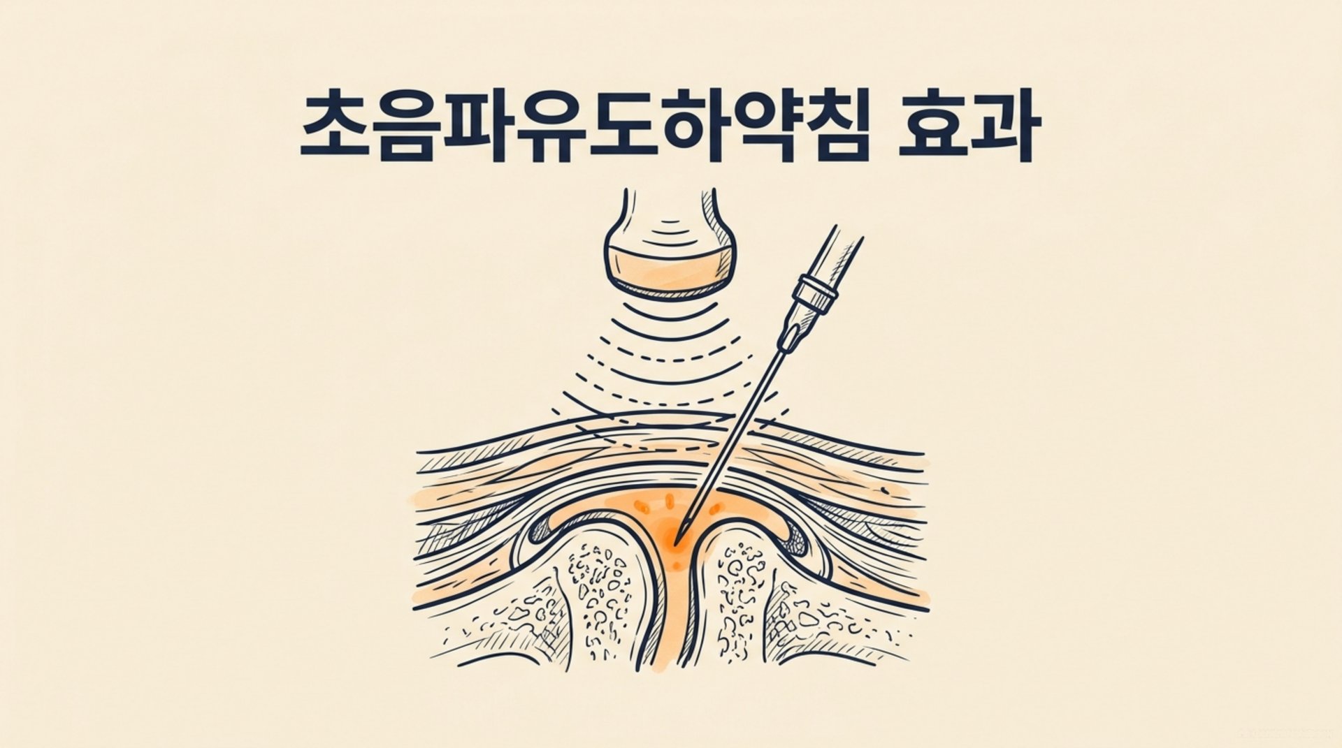 남가좌동 한의원 (초음파유도하약침 효과) 안내 이미지