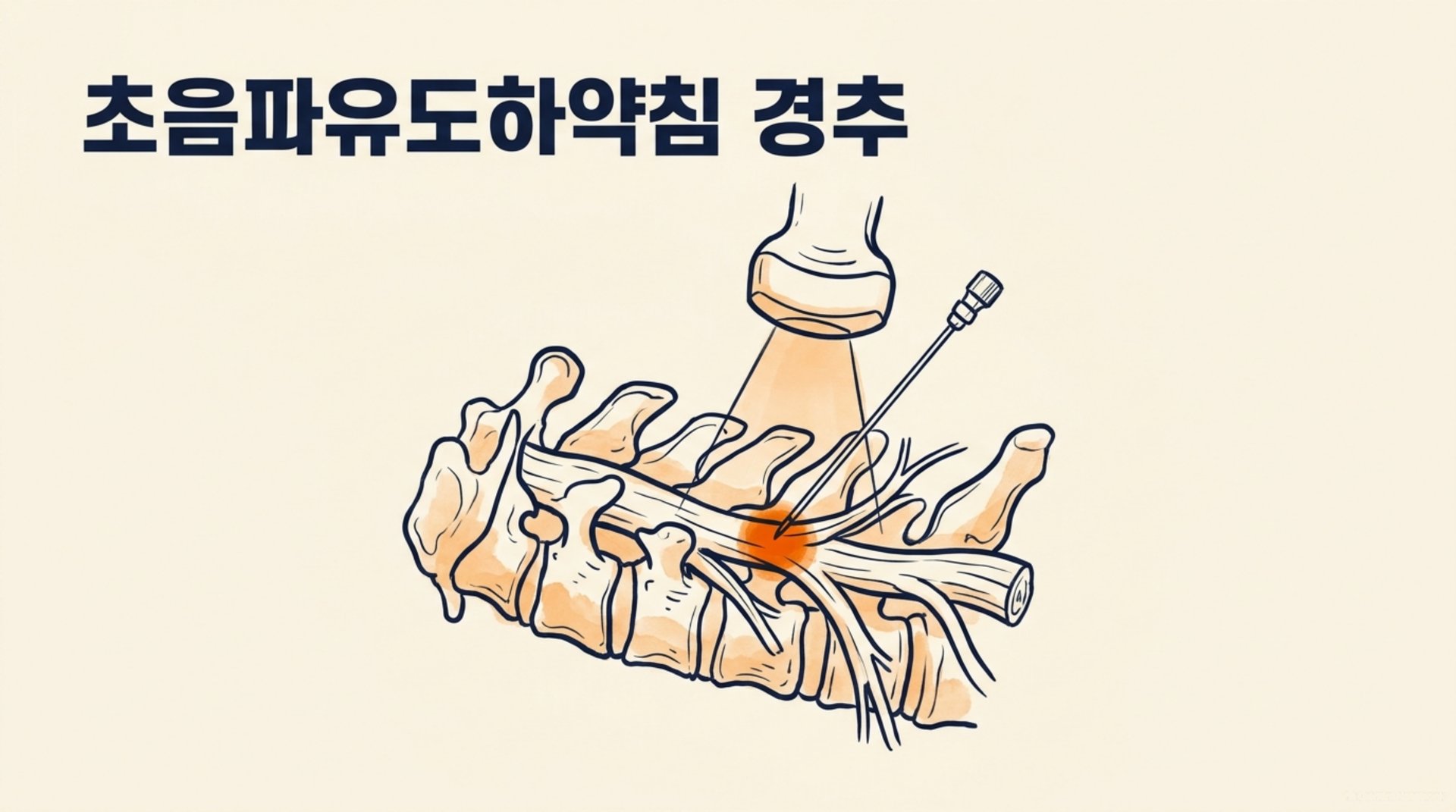 남가좌동 한의원 초음파유도하약침 경추 안내 이미지