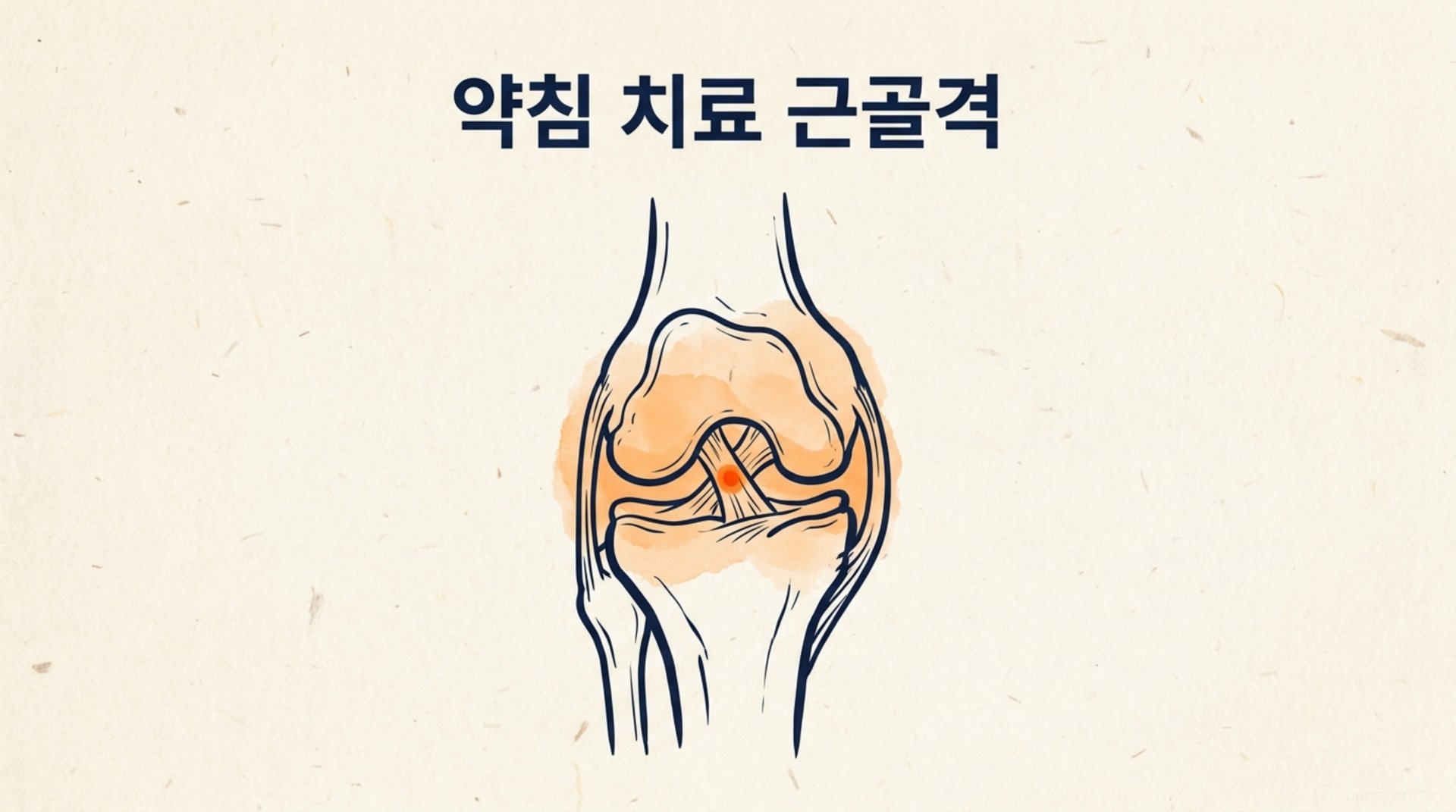 남가좌동 한의원 약침 치료 근골격 안내 이미지