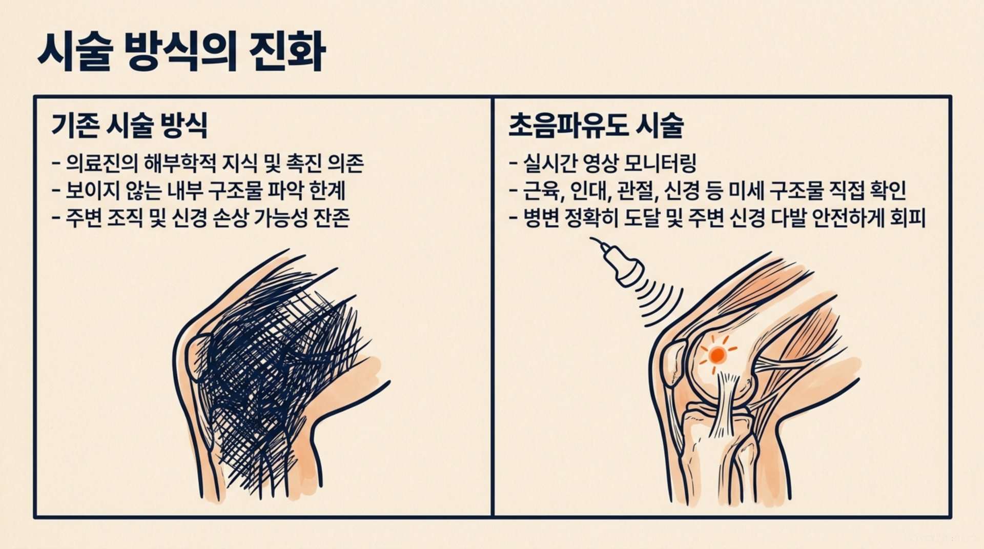 북가좌동 한의원 시술 방식의 진화 안내 이미지