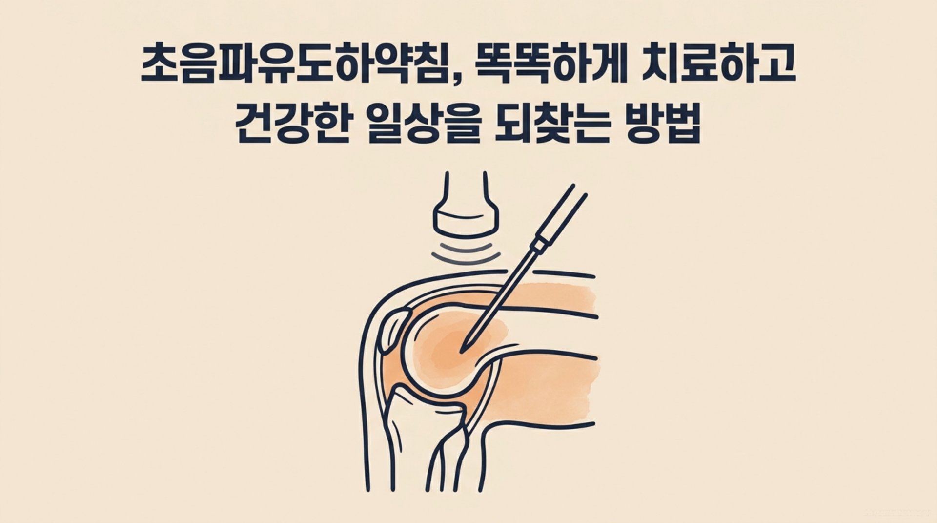 남가좌동 한의원 초음파유도하약침, 똑똑하게 치료하고 건강한 일상을 되찾는 방법 안내 이미지